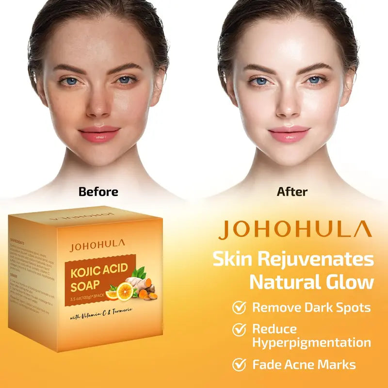 Johohula Turmeric Kojic Acid Soap, Dark Spot Corrector Soap Bars with Vitamin C, Retinol, Collagen, Turmeric - Smooth for Face and Body, Firm and Smooth Skin - 3 X 100G Bars